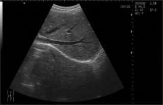 notebook Ultrasound Scanner transvaginal probe Cardiac  