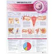 Infertility Anatomical Chart, (1587798581), Lippincott Williams 