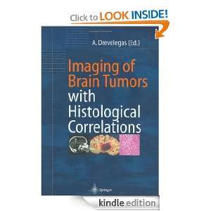 Imaging of the Brain with Histological Correlations Antonios 